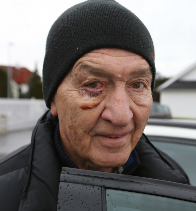 Ivo Pavlík před klinikou, kam si přišel nechat vytáhnout stehy.