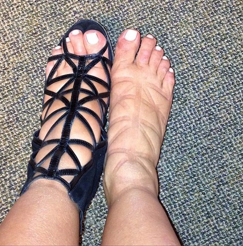 Snímek oteklých nohou, který Kim zveřejnila na Twitteru začátkem dubna. Ani boty za stovky dolarů zřejmě nejsou pohodlné tak, jak doufala.