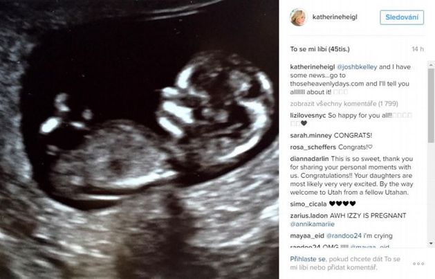 Katherine se pochlubila i snímkem z ultrazvuku.
