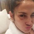 Jennifer Lopez se objevila s pohmožděným okem.