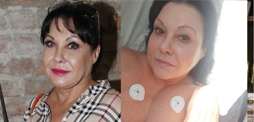 Dagmar Patrasová se podrobila operaci.