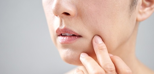 Jestliže vám koutky praskají opakovaně a balzám na rty vám nepomáhá, je načase odhalit příčinu.