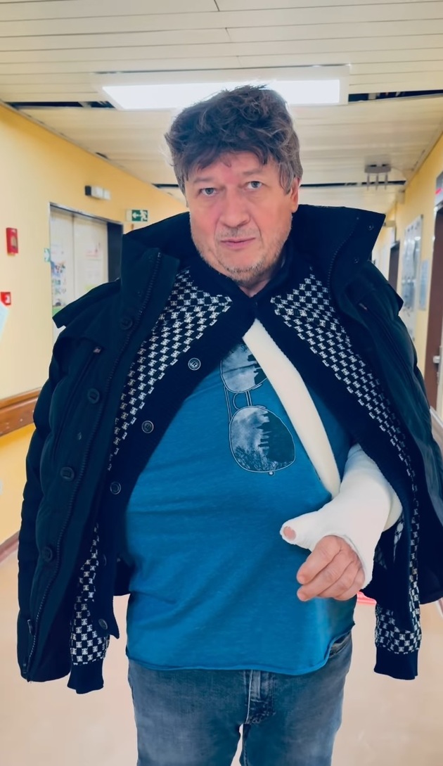 Režisér má zlomené obě ruce. 