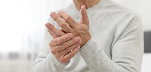 Syndrom karpálního tunelu vzniká utlačením středního nervu procházejícího úzkým kanálkem v zápěstí.